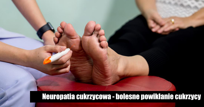 Neuropatia cukrzycowa - bolesne powikanie cukrzycy