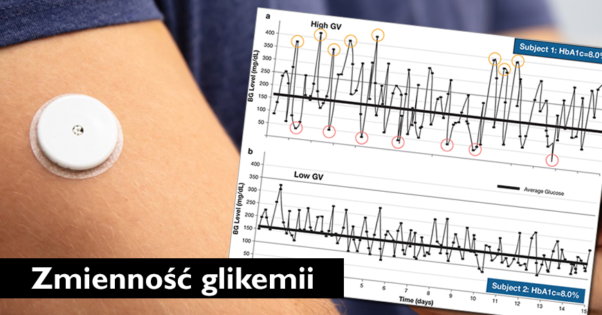 Zmienno glikemii  - jeden z kluczowych elementw wyrwnania cukrzycy