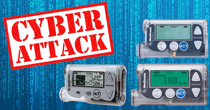 Zagroenie bezpieczestwa cybernetycznego pomp insulinowych